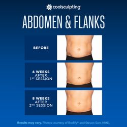 The Spa Boutique CoolSculpting of Trinity - Men struggle with stubborn fat on the abdomen and love handles. If this is you, give us a call for a free consultation.