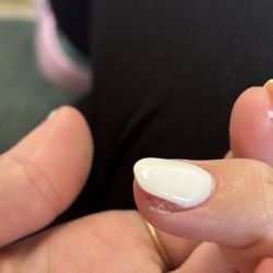 Sydney's Nails & Spa - 1 of 4 fingers where he filed my skin raw