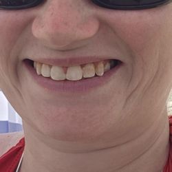 Ridge Pike Dental Care - Started here!