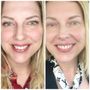 Photo of Hero Orthodontics