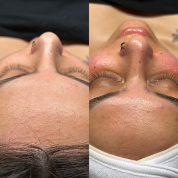 Beauty By Sambina - Dermaplaning delight treatment - Permanent Makeup Near Me - Spring , Texas Beauty By Sambina - Dermaplaning delight treatment - Permanent Makeup Near Me - Spring , Texas