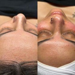 Beauty By Sambina - Dermaplaning delight treatment