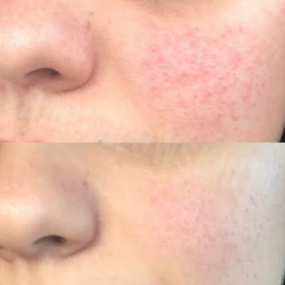 Bare Glow Skin & Body