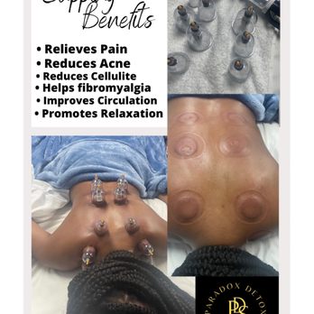 Paradox Detox Spa - Cupping is a very beneficial massage that helps to relax the muscles, promote circulation, relaxation etc.... - Massage Near Me - Lauderdale, Florida
