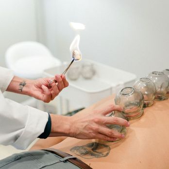 Taproot Acupuncture & Herbs - We offer a variety of complementary treatments including fire cupping, moxibustion, Tui Na (Chinese massage), and Gua Sha (skin stroking) - Acupuncture Near Me - Sierra Madre, California Taproot Acupuncture & Herbs - We offer a variety of complementary treatments including fire cupping, moxibustion, Tui Na (Chinese massage), and Gua Sha (skin stroking) - Acupuncture Near Me - Sierra Madre, California