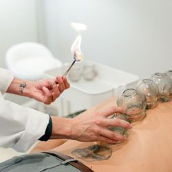 Taproot Acupuncture & Herbs - We offer a variety of complementary treatments including fire cupping, moxibustion, Tui Na (Chinese massage), and Gua Sha (skin stroking)