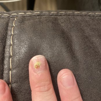 Premier Nail Bar - infection of finger nail - Nail Salons Near Me - Conroe, Texas