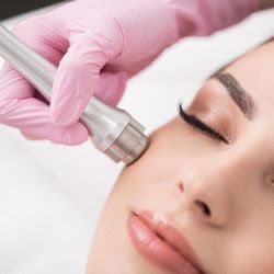 Leegerem Advance Aesthetic Techniques - Microdermabrasion