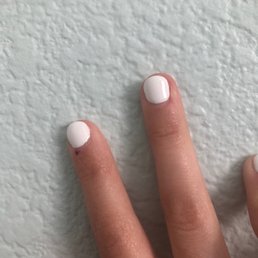 One on index visibly seen. Middle finger to the right bled during cuticle cutting.