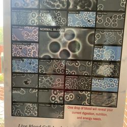 Cass Chiropractic - Blood analysis