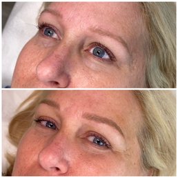 Before and After Before and After