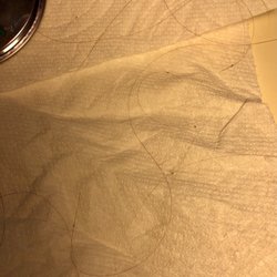 Lice Happens - Phoenix/Scottsdale - Some of the nits we found.