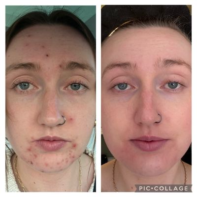 Natural Skincare Clinic