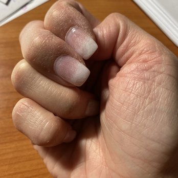 Nail Style Salon and Spa - Dry fingers from the long acetone soak and chipped topcoat. I just had my nails done yesterday. - Nail Salons Near Me - Lawrenceville, Georgia