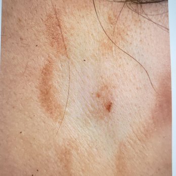 Flawless Skin Center - Laser Hair Removal Near Me - Burbank, California Flawless Skin Center - Laser Hair Removal Near Me - Burbank, California