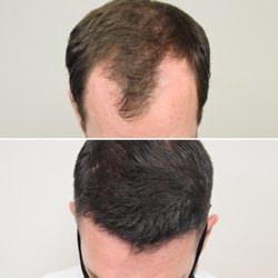 LA FUE Hair - New York