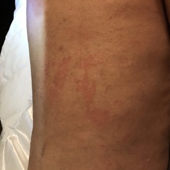 European Wax Center - Back of thigh - Waxing Near Me - Savannah, Georgia