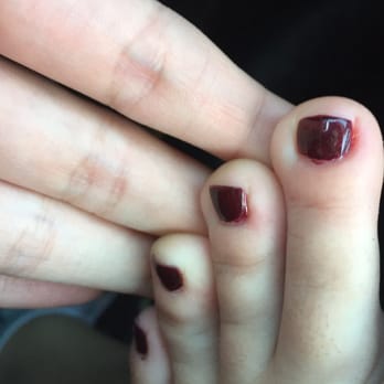 One Hour Nail - My pedicure looks awful and the nails on my feet actually hurt. They are super red and painful. - Nail Salons Near Me - Ontario, California