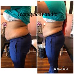 Icandy Body Studio - First fat reduction. See results every session after 30-60 mins.