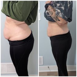 Lee Beauty Med Spa - Body sculpting