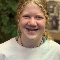 Cloward Orthodontics - Last time in braces! Teeth are straight and the braces are coming off!