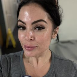 Still glowing even at work day after treatments Still glowing even at work day after treatments