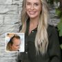 Photo of Natural Transplants, Hair Restoration Clinic