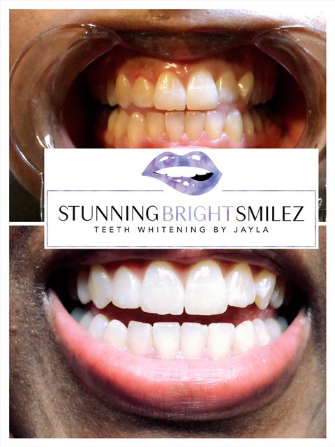 Stunningbrightsmilez Logo