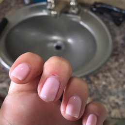 Bleeding cuticle after gel manicure. Bleeding cuticle after gel manicure.