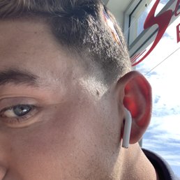 My eye brow cut by the barber not paying attention. My eye brow cut by the barber not paying attention.