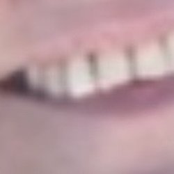 Elizabeth Miro, DDS - Before