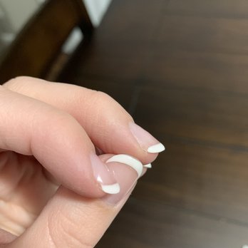 Ocean Spa And Nails - Peeling after the "fix" - Waxing Near Me - Reno, Nevada Ocean Spa And Nails - Peeling after the "fix" - Waxing Near Me - Reno, Nevada
