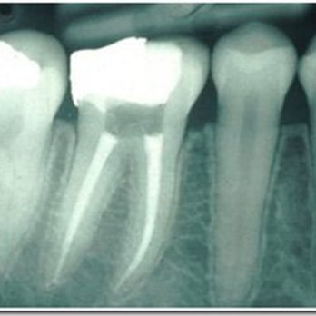 Ana R Ortiz, DDS - Root Canals - Oral Surgeons Near Me Ana R Ortiz, DDS - Root Canals - Oral Surgeons Near Me