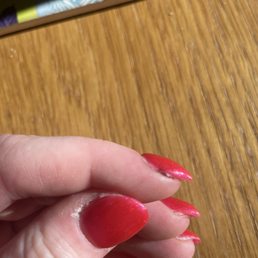 Right pointer finger - the brown part is where I was cut and the wound/blood was not cleaned.