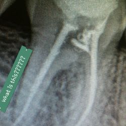 Caring Bear Dental - What is this??? Thanks caring bear dental for ruining my son's tooth now we have to redo the root canal!!