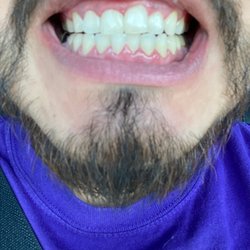 Beauty of Smile by Therez - Pearly whites