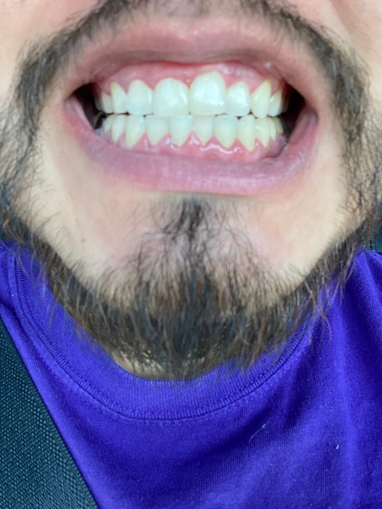 Beauty of Smile by Therez Logo