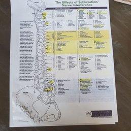 My areas that need work, circled by the doctors themselves and explained to me in depth! My areas that need work, circled by the doctors themselves and explained to me in depth!