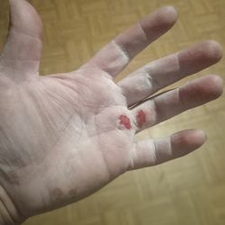 Crossfit New Caney - Ahhhhh the had rip from pull ups!!