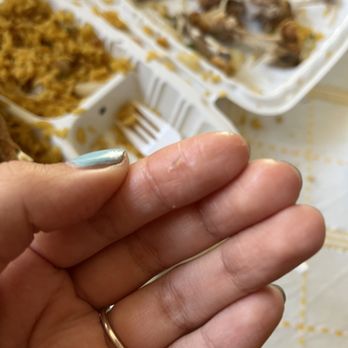 Zhengs Restaurant - This is starting to get annoying. Every time I go there's always hair in my food! Now there's actually GLASS. - Chinese Near Me - Riverdale, Maryland Zhengs Restaurant - This is starting to get annoying. Every time I go there's always hair in my food! Now there's actually GLASS. - Chinese Near Me - Riverdale, Maryland