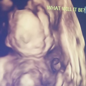 Prenatal Cinemas - Ultrasound Imaging Centers Near Me - Harbor City, California