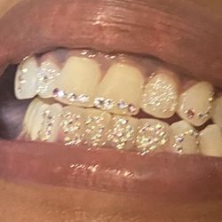 Glam Smiles St Louis - Tooth gems