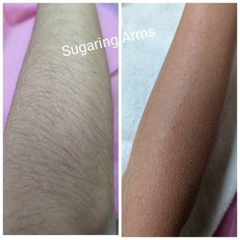 Sugar and Wax Studio - Arms Sugaring - Waxing Near Me - Campbell, California Sugar and Wax Studio - Arms Sugaring - Waxing Near Me - Campbell, California