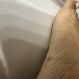 Cut from pedicure! Ouch!!! Kate was nail tech.