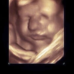 Baby Preview