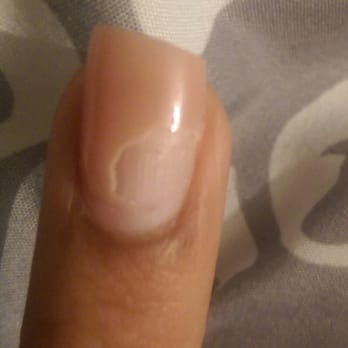 Modern Nail - 3rd nail that broke off and shellac peeling off effortlessly. - Nail Salons Near Me - San Antonio, Texas Modern Nail - 3rd nail that broke off and shellac peeling off effortlessly. - Nail Salons Near Me - San Antonio, Texas