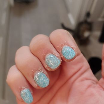 Aloha Nail - Cuticles on my other hand. I can't stress enough to not go here. - Nail Salons Near Me - Las Vegas, Nevada Aloha Nail - Cuticles on my other hand. I can't stress enough to not go here. - Nail Salons Near Me - Las Vegas, Nevada