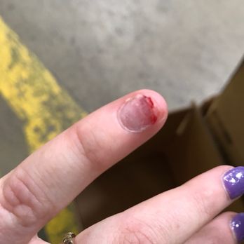 Geist Nails - My sisters nail after cleaning it a little after the artificial nail ripped off. - Nail Salons Near Me - Fishers, Indiana
