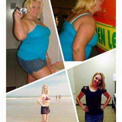 The Center for Surgical Weight Loss at Lake Norman - I had my weight loss surgery in 2014, and have been able to maintain my goal. Wonderful experience