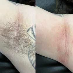 Bare Michigan - Before/After Underarm wax